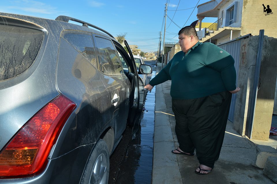 Family in Kurdistan Region seeks medical help abroad to treat obese children 